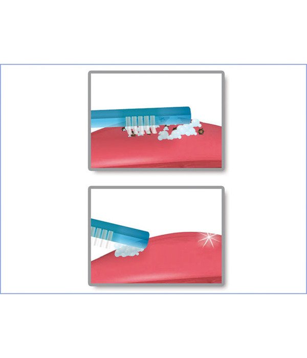 Tong-Clin De Luxe miradent liežuvio valiklis